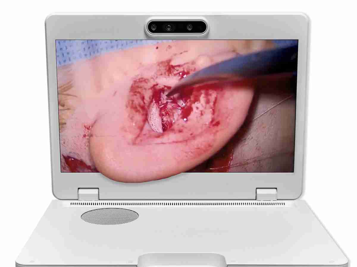 达擎之＂Heads-up 3D显微手术显示系统＂，，整合4K裸眼3D显示及眼球追踪系统，，，，具备快速追踪人眼移动位置功能，，，，减轻医师长时间维持固定姿势的负担，，，让医师能有更宽广清晰的3D立体视野及更舒适的姿势来执行手术。。。。